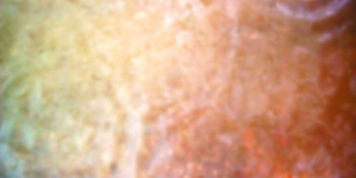 Bonuses Free Spins Games